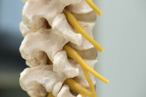 Lumbale-kanaalstenose-Fysiotherapie Wieenhof Venray