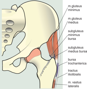 Trochanter-major-pijnsyndroom-l-Fysiotherapie wieenhof Venray