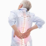 Ziekte-van-Scheuermann-l-Fysiotherapie wieenhof venray