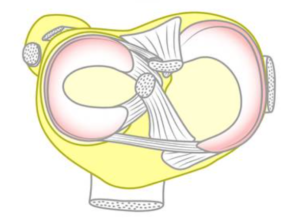 Degeneratief-meniscus-letsel-l-Oorzaak-en-behandeling-Fysiotherapie wieenhof Venray
